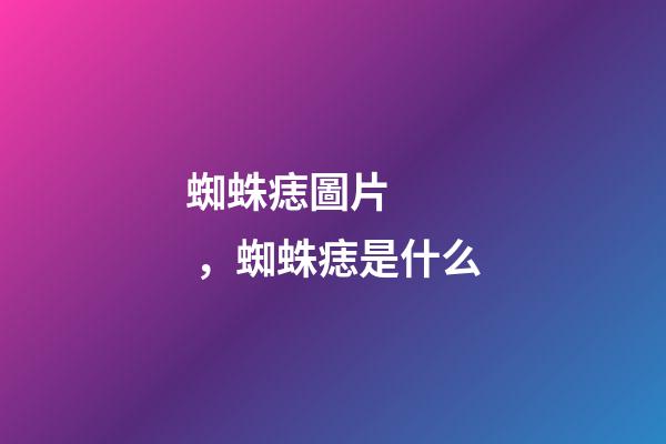 蜘蛛痣圖片，蜘蛛痣是什么